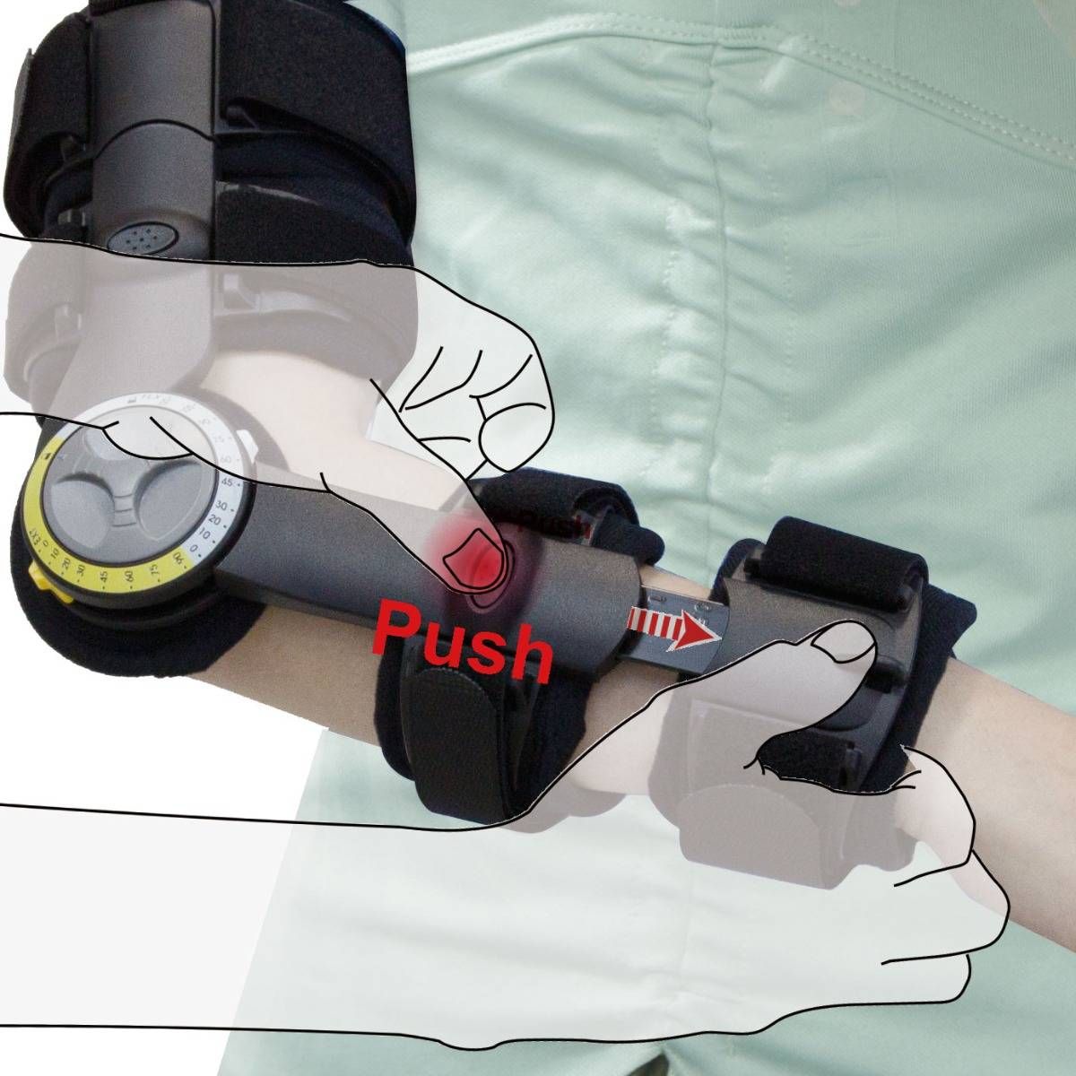 Conwell Extendable ROM Elbow Brace