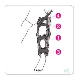 Extendable Knee Brace - ROM - Conwell