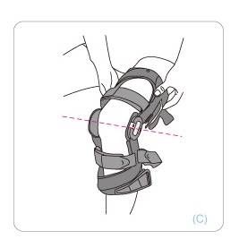 Conwell Ligament ROM Knee Brace, Right/Left